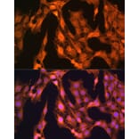 Immunofluorescence - Anti-LASP1 Antibody (A11701) - Antibodies.com
