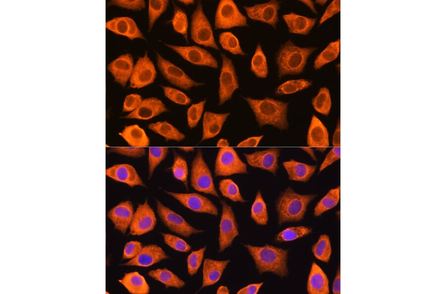 Immunofluorescence - Anti-LASP1 Antibody (A11701) - Antibodies.com