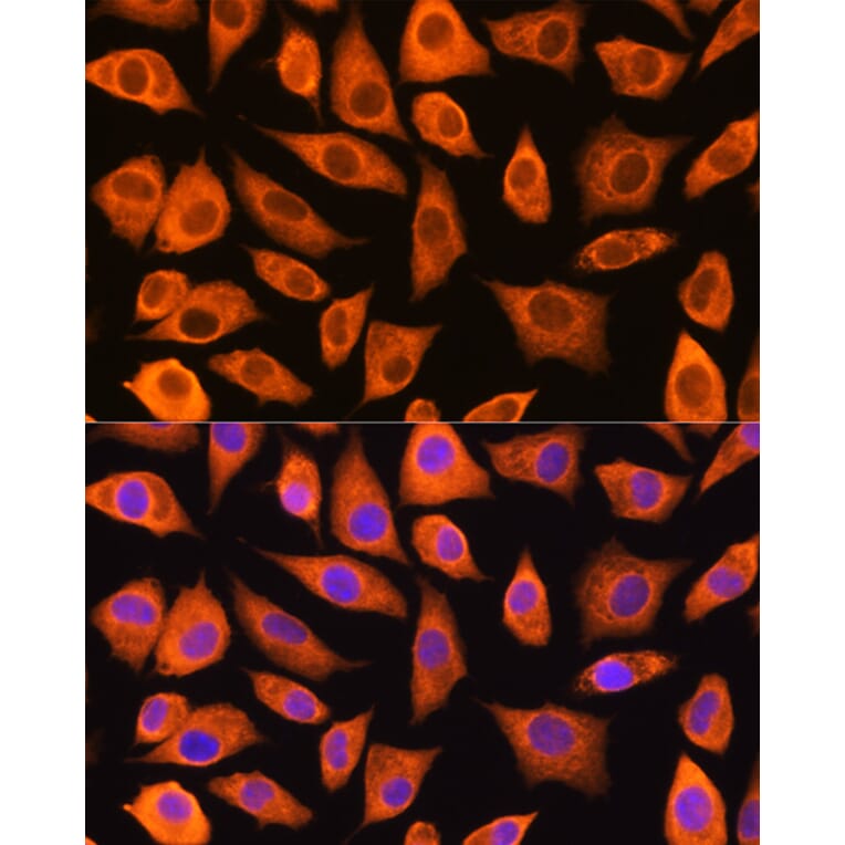 Immunofluorescence - Anti-LASP1 Antibody (A11701) - Antibodies.com