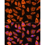 Immunofluorescence - Anti-LASP1 Antibody (A11701) - Antibodies.com