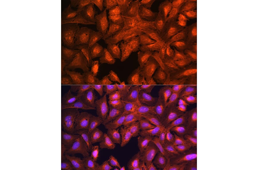 Immunofluorescence - Anti-LASP1 Antibody (A11701) - Antibodies.com