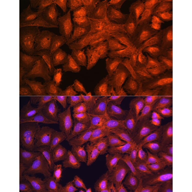 Immunofluorescence - Anti-LASP1 Antibody (A11701) - Antibodies.com
