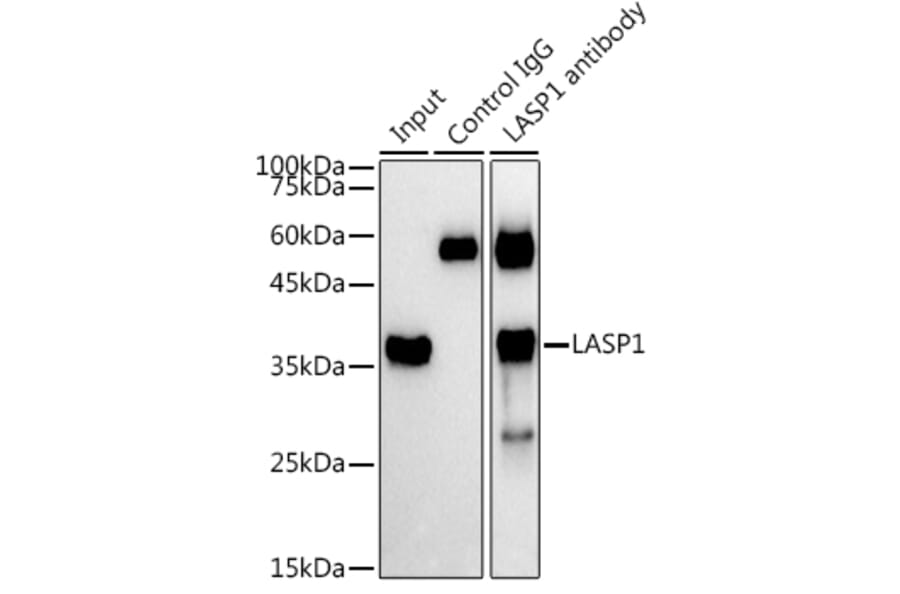 Western Blot - Anti-LASP1 Antibody (A11701) - Antibodies.com