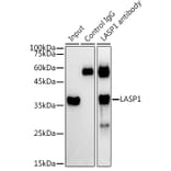 Western Blot - Anti-LASP1 Antibody (A11701) - Antibodies.com