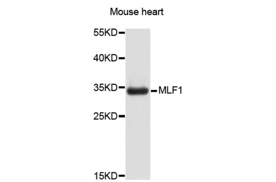 Western Blot - Anti-MLF1 Antibody (A3960) - Antibodies.com