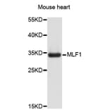 Western Blot - Anti-MLF1 Antibody (A3960) - Antibodies.com