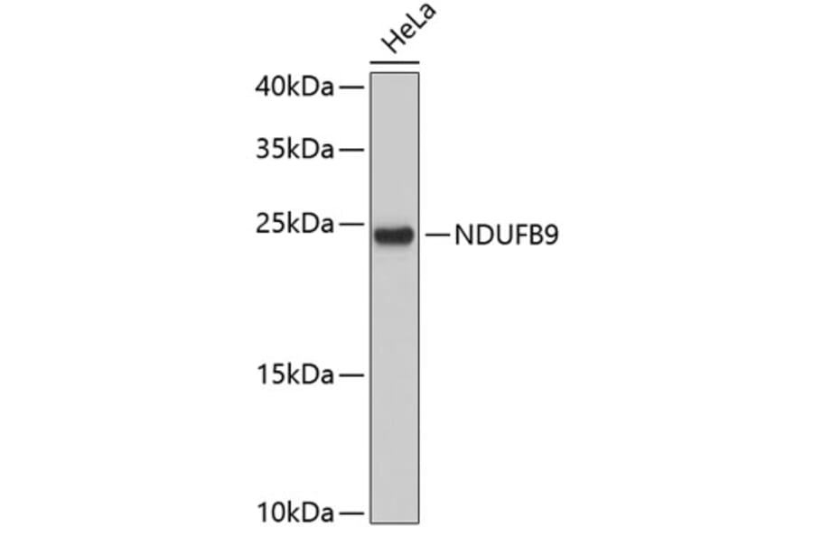 Western Blot - Anti-NDUFB9 Antibody (A3981) - Antibodies.com