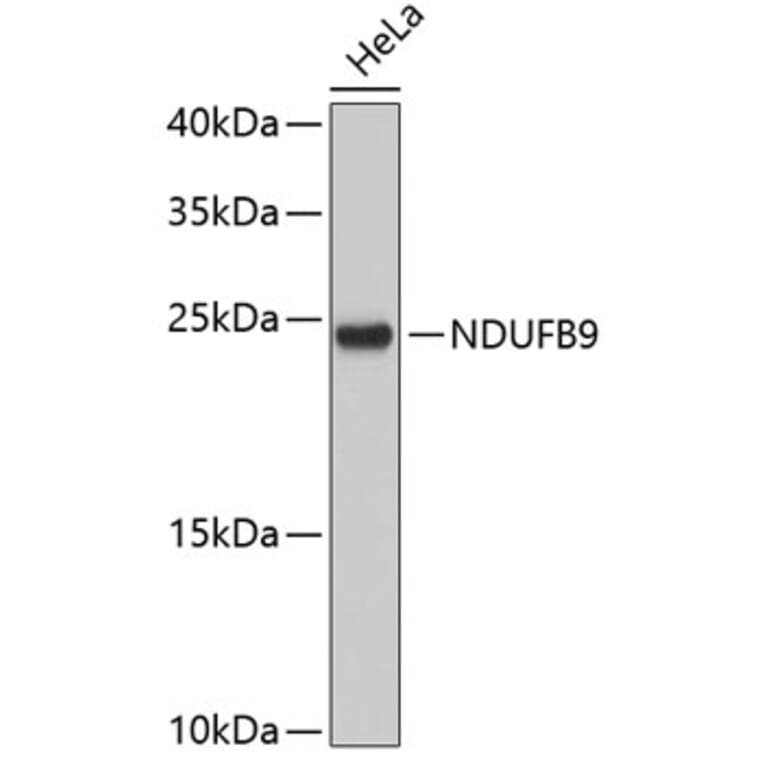 Western Blot - Anti-NDUFB9 Antibody (A3981) - Antibodies.com
