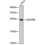 Western Blot - Anti-NDUFB9 Antibody (A3981) - Antibodies.com