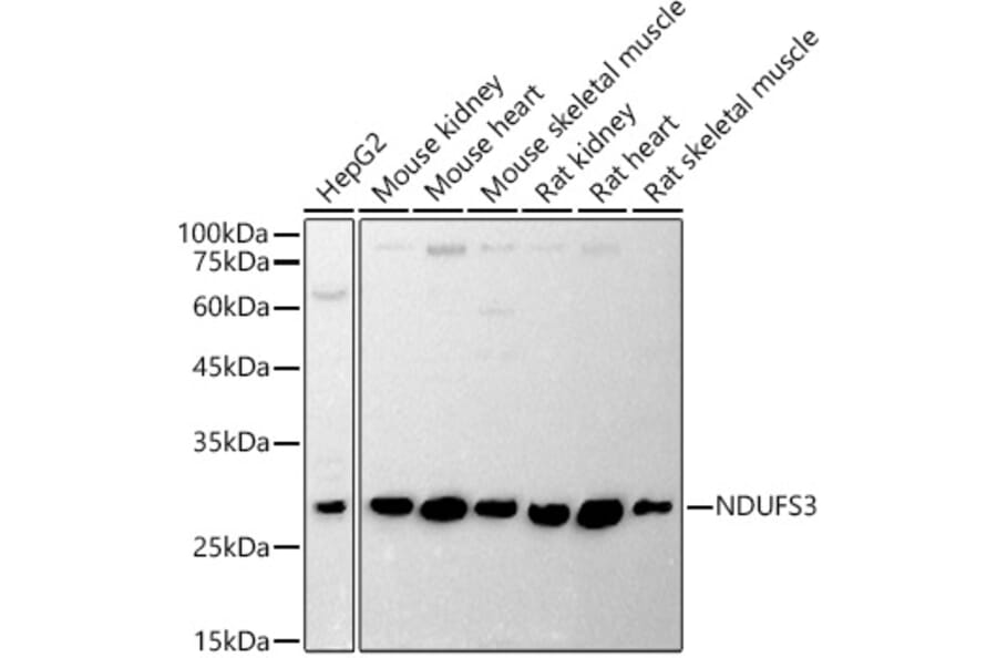 Western Blot - Anti-NDUFS3 Antibody (A11705) - Antibodies.com