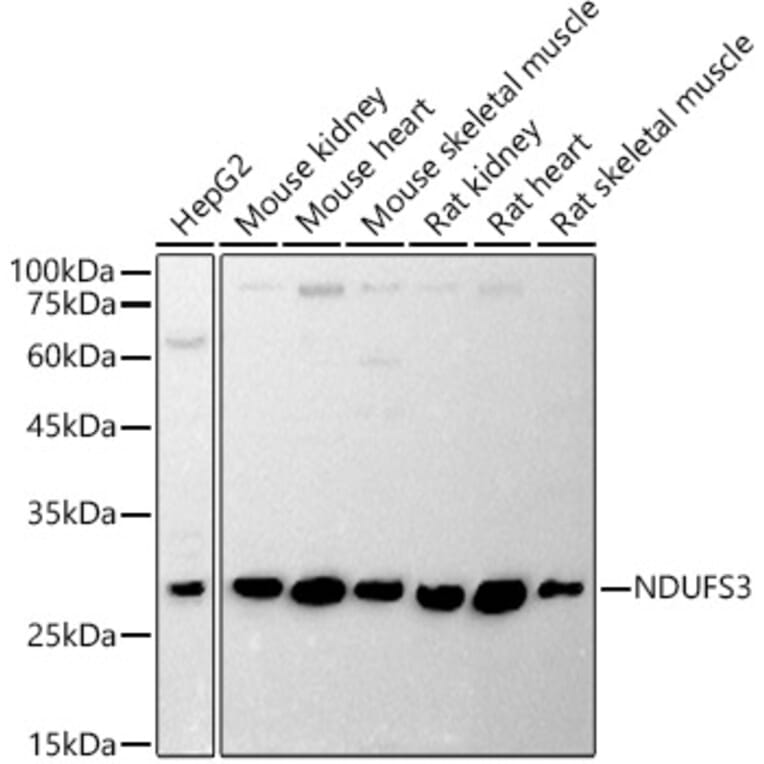 Western Blot - Anti-NDUFS3 Antibody (A11705) - Antibodies.com