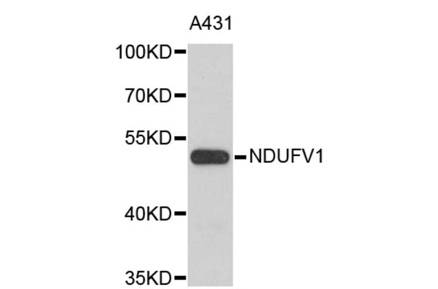 Western Blot - Anti-NDUFV1 Antibody (A3984) - Antibodies.com