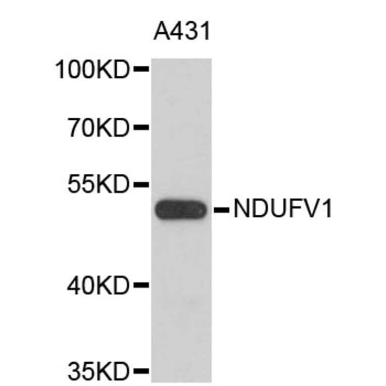 Western Blot - Anti-NDUFV1 Antibody (A3984) - Antibodies.com