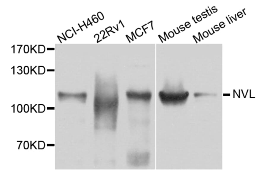 Western Blot - Anti-NVL Antibody (A3995) - Antibodies.com