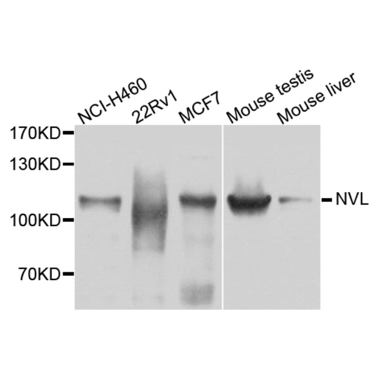 Western Blot - Anti-NVL Antibody (A3995) - Antibodies.com