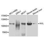 Western Blot - Anti-NVL Antibody (A3995) - Antibodies.com