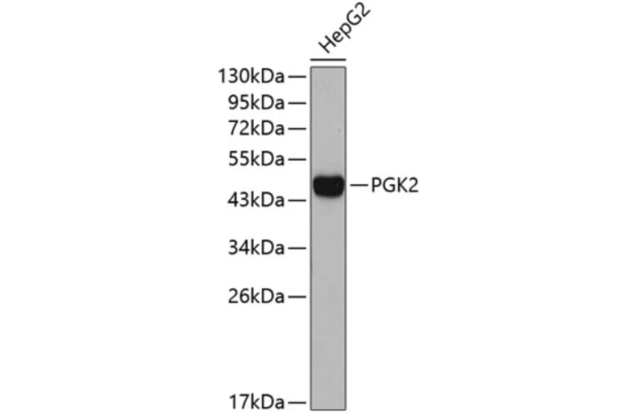 Western Blot - Anti-PGK2 Antibody (A4017) - Antibodies.com