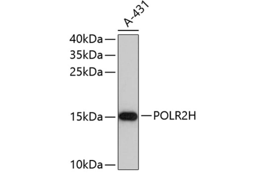 Western Blot - Anti-POLR2H Antibody (A4030) - Antibodies.com