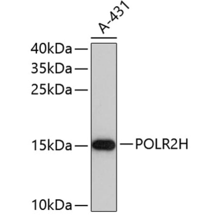 Western Blot - Anti-POLR2H Antibody (A4030) - Antibodies.com