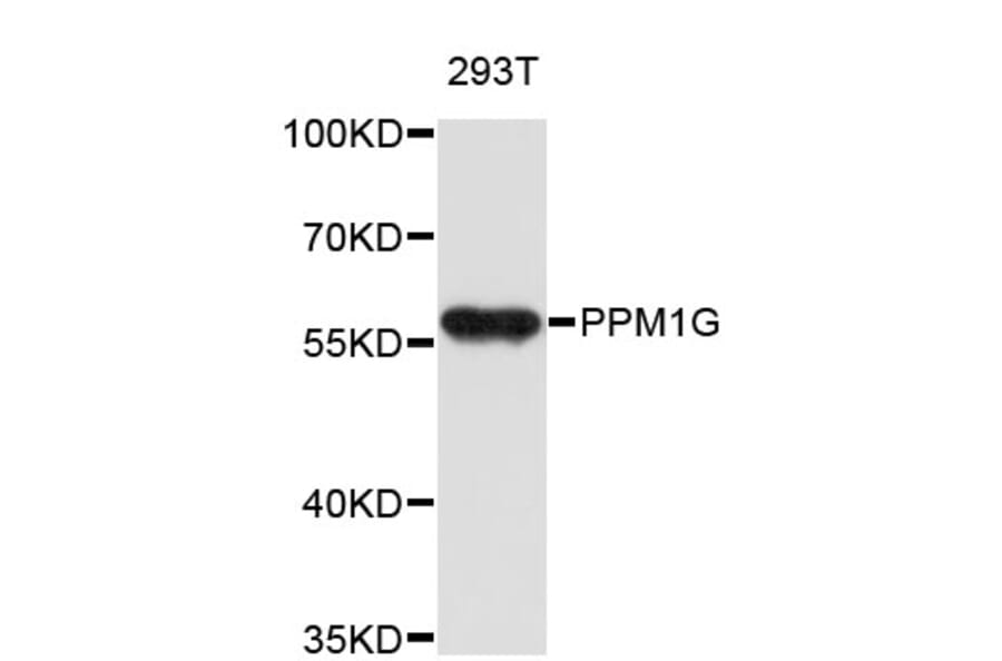 Western Blot - Anti-PPM1G Antibody (A4034) - Antibodies.com