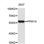 Western Blot - Anti-PPM1G Antibody (A4034) - Antibodies.com