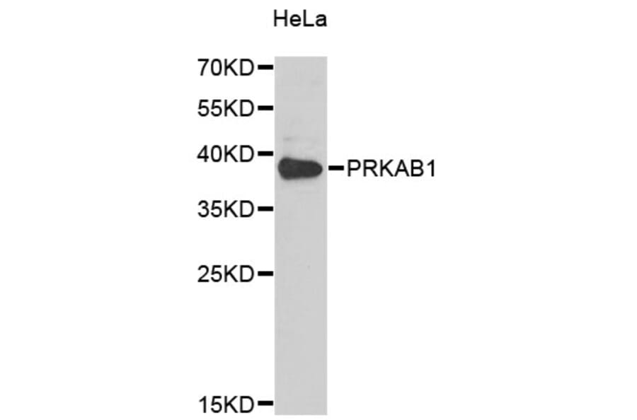 Western Blot - Anti-PRKAB1 Antibody (A4042) - Antibodies.com