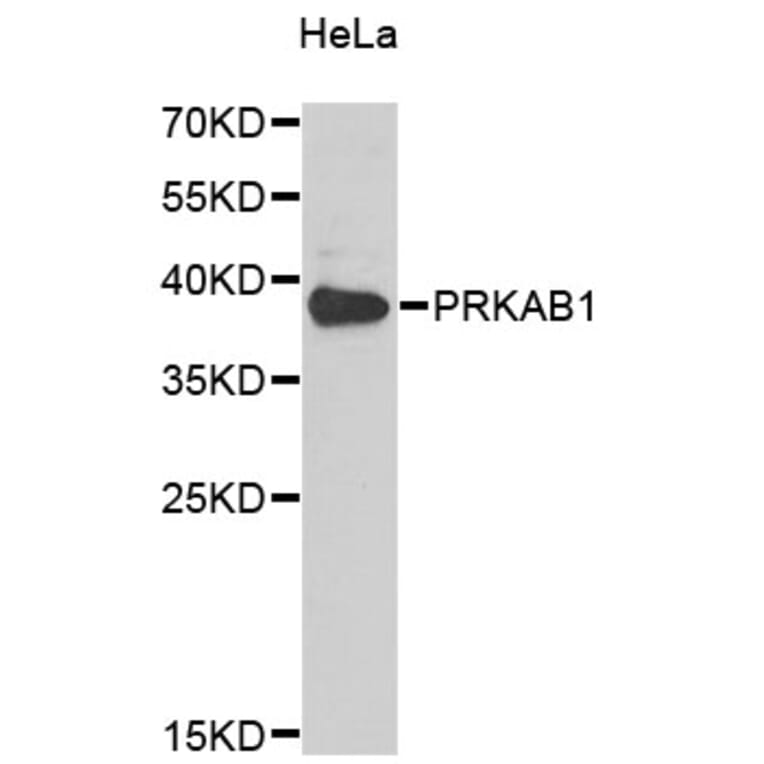 Western Blot - Anti-PRKAB1 Antibody (A4042) - Antibodies.com