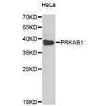 Western Blot - Anti-PRKAB1 Antibody (A4042) - Antibodies.com