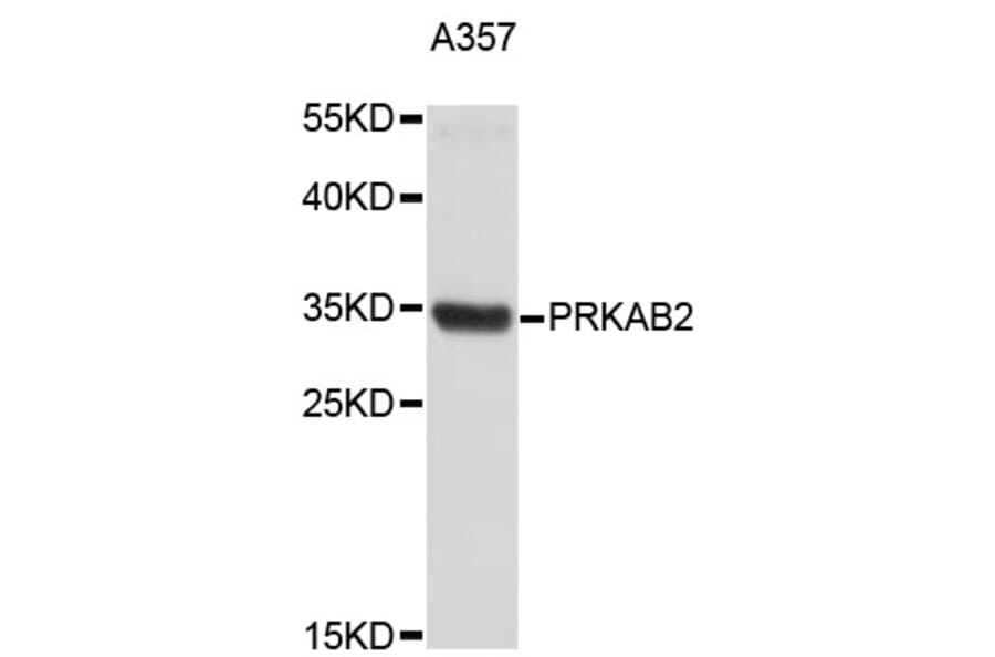 Western Blot - Anti-PRKAB2 Antibody (A4043) - Antibodies.com