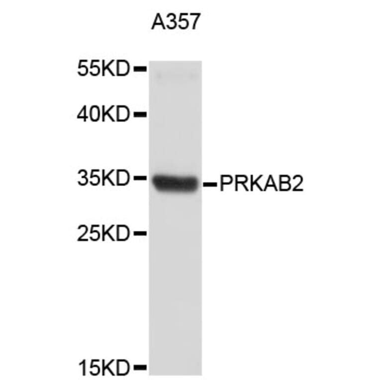 Western Blot - Anti-PRKAB2 Antibody (A4043) - Antibodies.com
