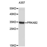 Western Blot - Anti-PRKAB2 Antibody (A4043) - Antibodies.com
