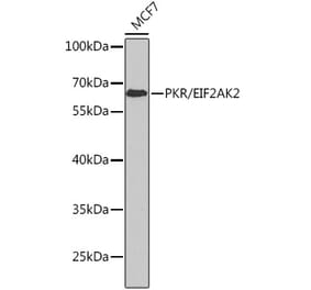 Western Blot - Anti-PKR Antibody (A11716) - Antibodies.com