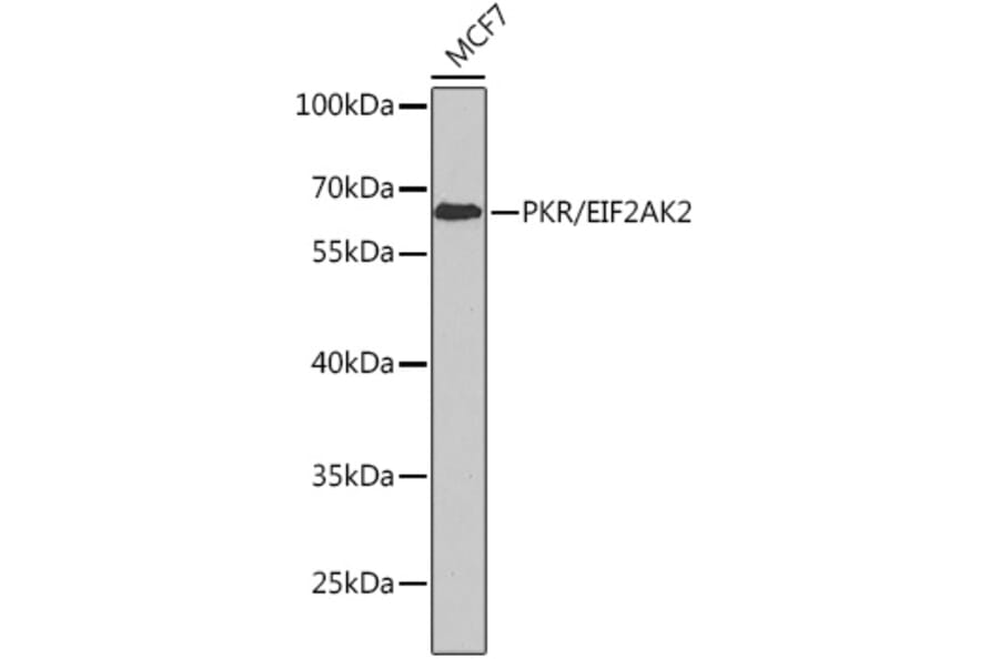 Western Blot - Anti-PKR Antibody (A11716) - Antibodies.com