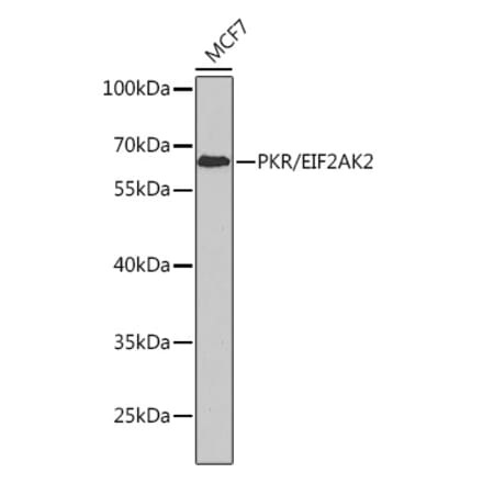 Western Blot - Anti-PKR Antibody (A11716) - Antibodies.com