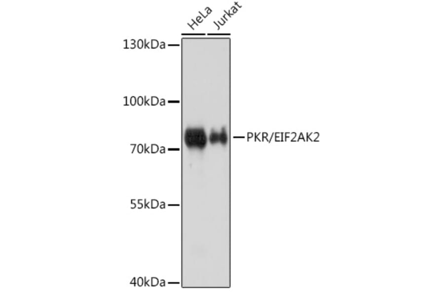 Western Blot - Anti-PKR Antibody (A11716) - Antibodies.com