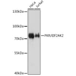 Western Blot - Anti-PKR Antibody (A11716) - Antibodies.com