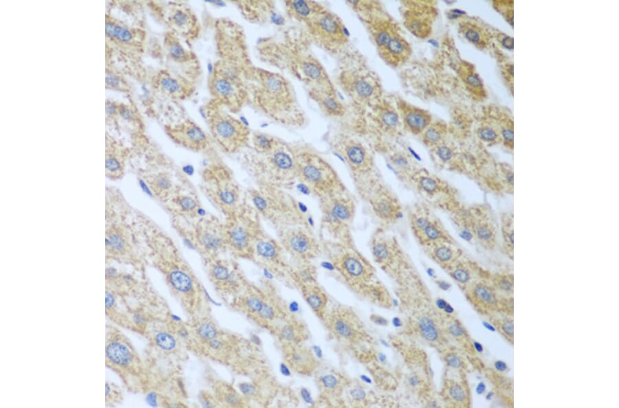 Immunohistochemistry - Anti-PKR Antibody (A11716) - Antibodies.com