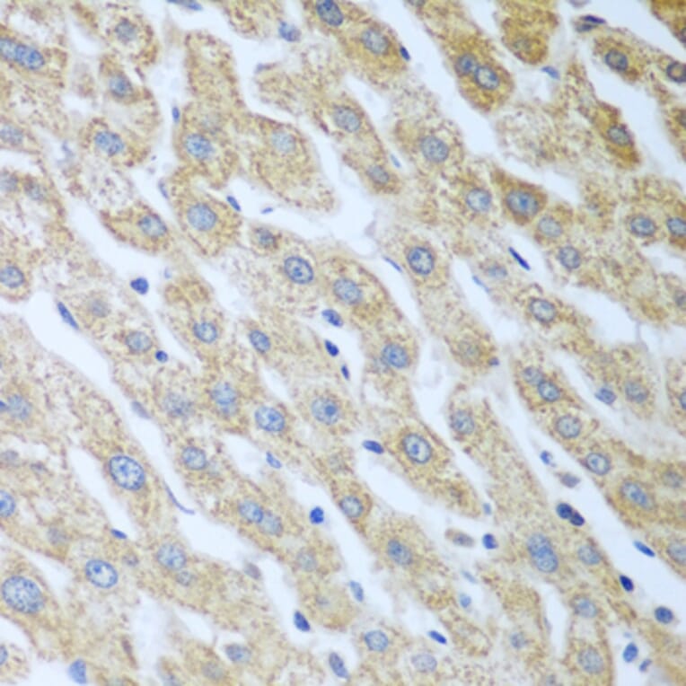 Immunohistochemistry - Anti-PKR Antibody (A11716) - Antibodies.com