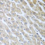 Immunohistochemistry - Anti-PKR Antibody (A11716) - Antibodies.com