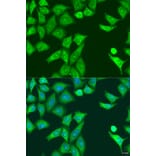 Immunofluorescence - Anti-PKR Antibody (A11716) - Antibodies.com