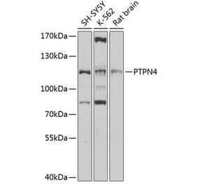 Western Blot - Anti-MEG1 Antibody (A11717) - Antibodies.com