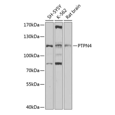 Western Blot - Anti-MEG1 Antibody (A11717) - Antibodies.com