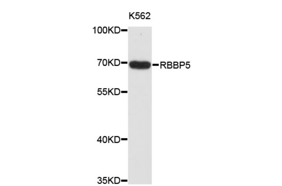Western Blot - Anti-RBBP5 Antibody (A4072) - Antibodies.com