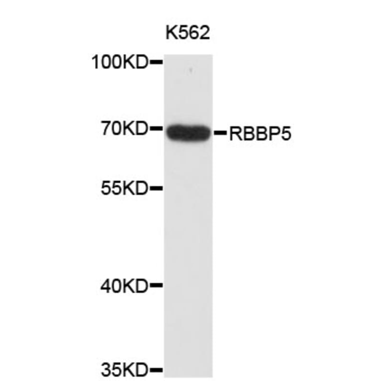 Western Blot - Anti-RBBP5 Antibody (A4072) - Antibodies.com