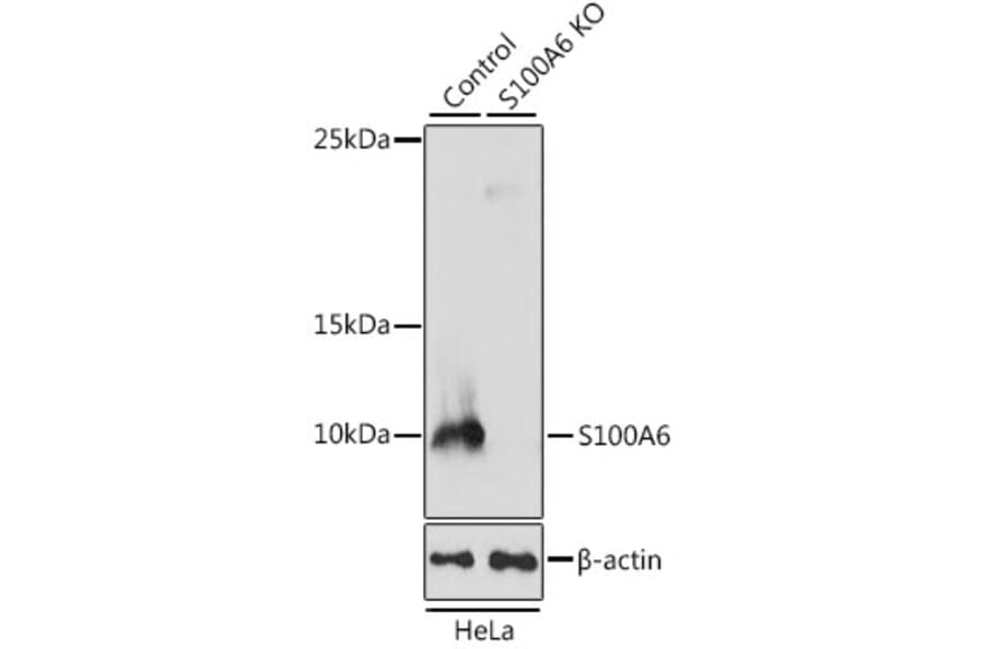 Western Blot - Anti-S100 alpha 6/PRA Antibody (A11719) - Antibodies.com