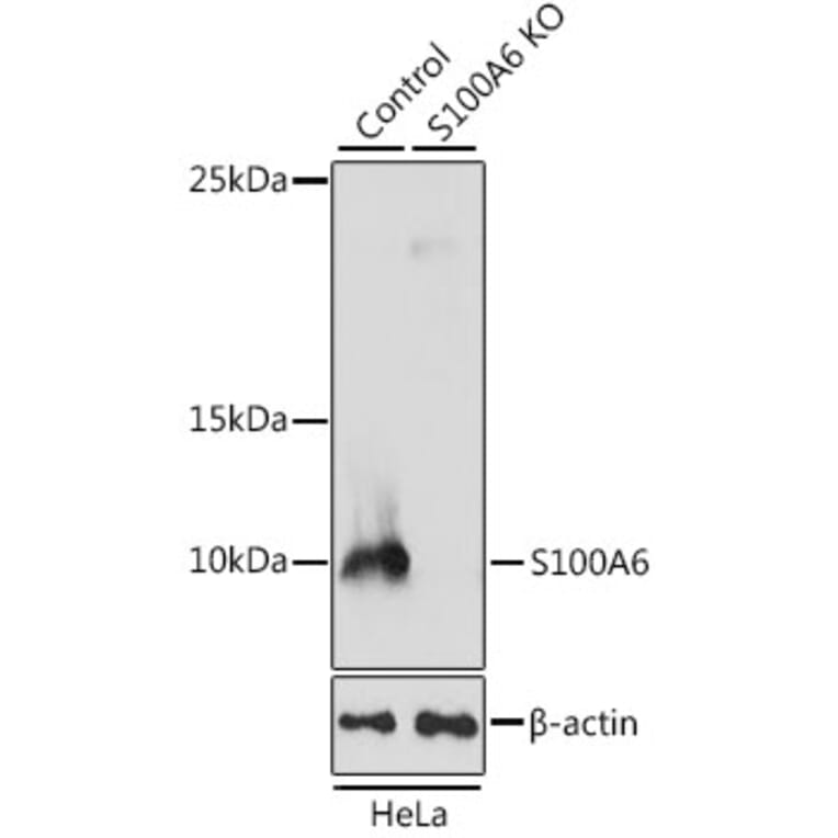 Western Blot - Anti-S100 alpha 6/PRA Antibody (A11719) - Antibodies.com