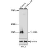 Western Blot - Anti-S100 alpha 6/PRA Antibody (A11719) - Antibodies.com