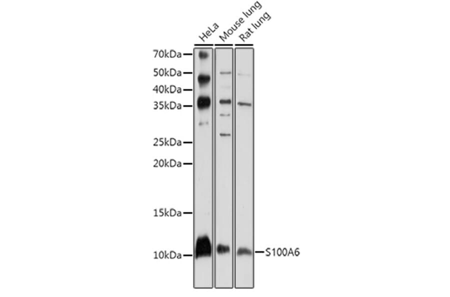 Western Blot - Anti-S100 alpha 6/PRA Antibody (A11719) - Antibodies.com