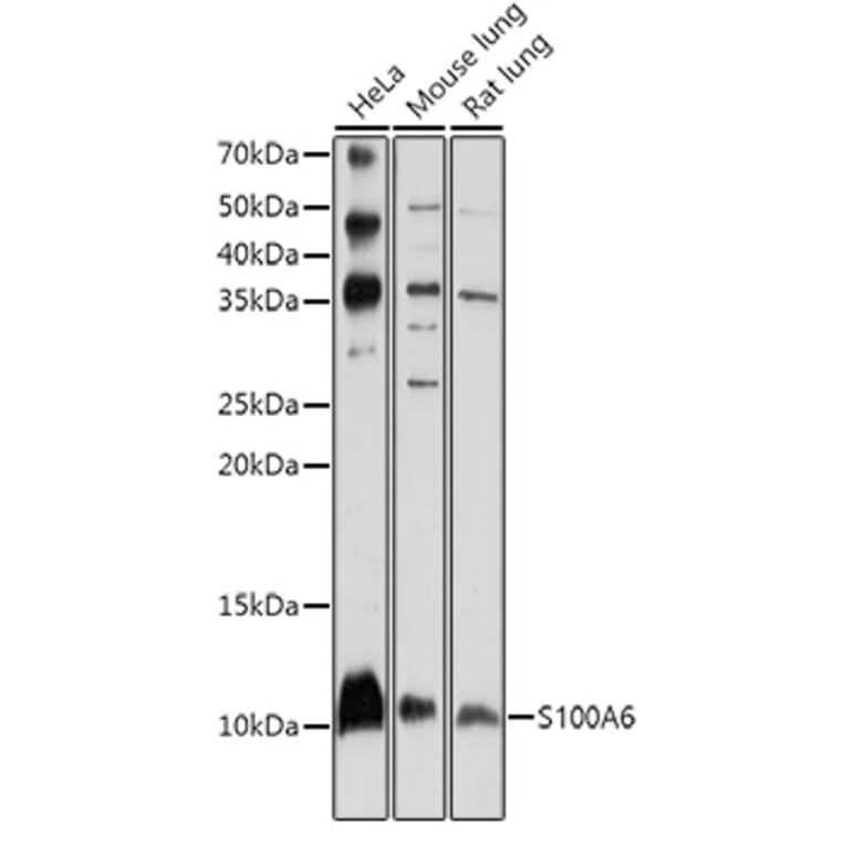 Western Blot - Anti-S100 alpha 6/PRA Antibody (A11719) - Antibodies.com