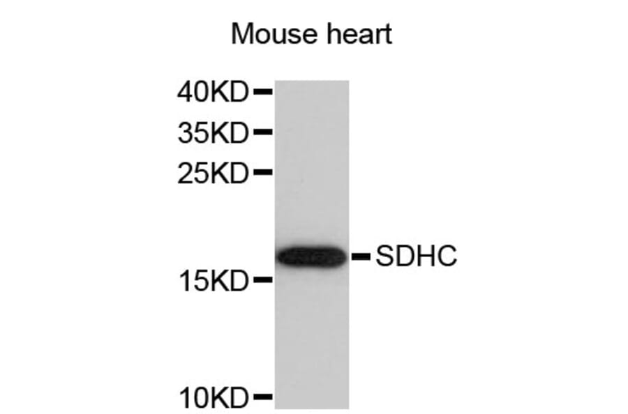 Western Blot - Anti-SDHC Antibody (A4106) - Antibodies.com